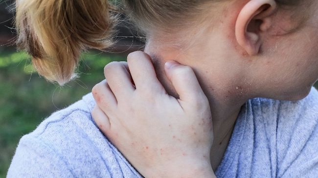психологические причины атопического дерматита у детей